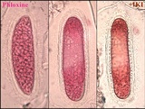 Pertusaria heterochroa image