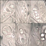 Lecidella elaeochroma f. elaeochroma image