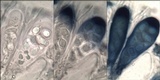 Lecidella elaeochroma f. elaeochroma image