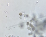 Hypomyces cervinigenus image