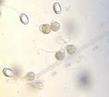 Hypomyces cervinigenus image