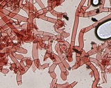 Botryobasidium danicum image
