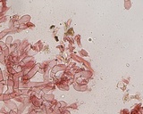 Botryobasidium danicum image