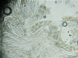 Trapelia glebulosa image