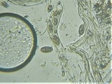 Trapelia glebulosa image