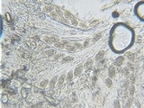 Trapelia glebulosa image