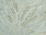 Trapelia glebulosa image