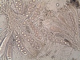 Trapelia glebulosa image