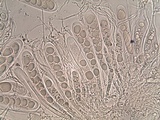 Trapelia glebulosa image