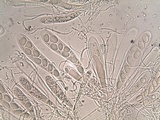 Trapelia glebulosa image