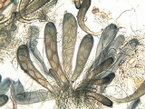Trapelia glebulosa image
