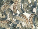 Trapelia glebulosa image
