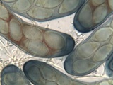 Trapelia glebulosa image