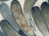Trapelia glebulosa image
