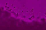 Exidiopsis galzinii image