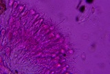 Exidiopsis galzinii image