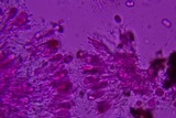 Exidiopsis galzinii image