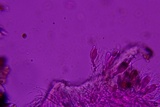 Exidiopsis galzinii image
