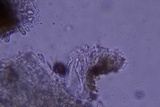 Exidiopsis galzinii image