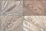 Ochrolechia parella image