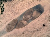 Ochrolechia parella image