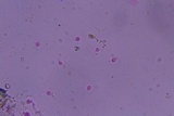 Tulasnella violea image