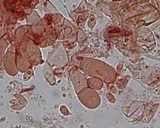 Botryobasidium rubiginosum image