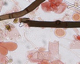 Botryobasidium rubiginosum image