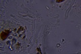 Byssomerulius corium image