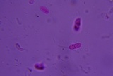 Myxarium nucleatum image