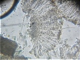 Polychidium muscicola image