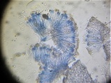 Polychidium muscicola image