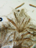 Triblidium caliciforme image