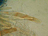 Triblidium caliciforme image