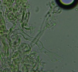 Radulomyces confluens image