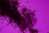 Botryobasidium simile image