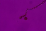 Botryobasidium simile image