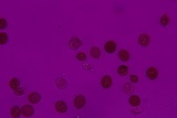Botryobasidium simile image