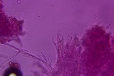 Hyphodontia arguta image