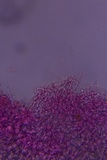 Hyphodontia arguta image