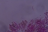 Hyphodontia arguta image