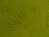 Hypomyces rosellus image