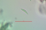 Lecanactis salicina image