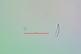 Lecanactis salicina image