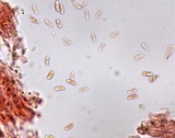 Hyphodontia quercina image