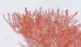 Hyphodontia quercina image
