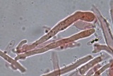 Hyphodontia quercina image