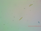 Lecanactis californica image