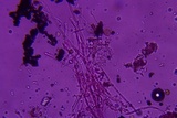 Hydnocristella himantia image