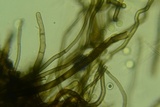 Pseudoplectania nigrella image